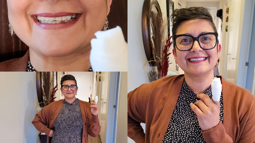 A collage of photos with a woman smiling, missing tooth, cut finger.